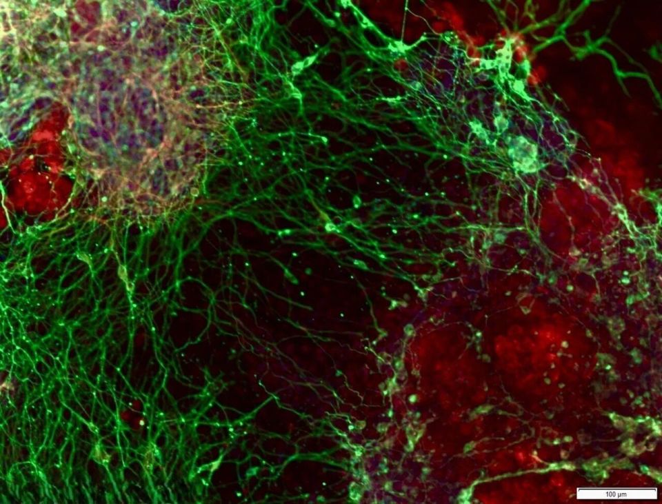 腦機接口與AI協同 過去一周腦科學與網絡技術研究新進展